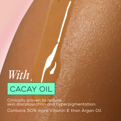 The Skin Support Oil - For Stretch Marks, Hyperpigmentation + Uneven Skin Texture
