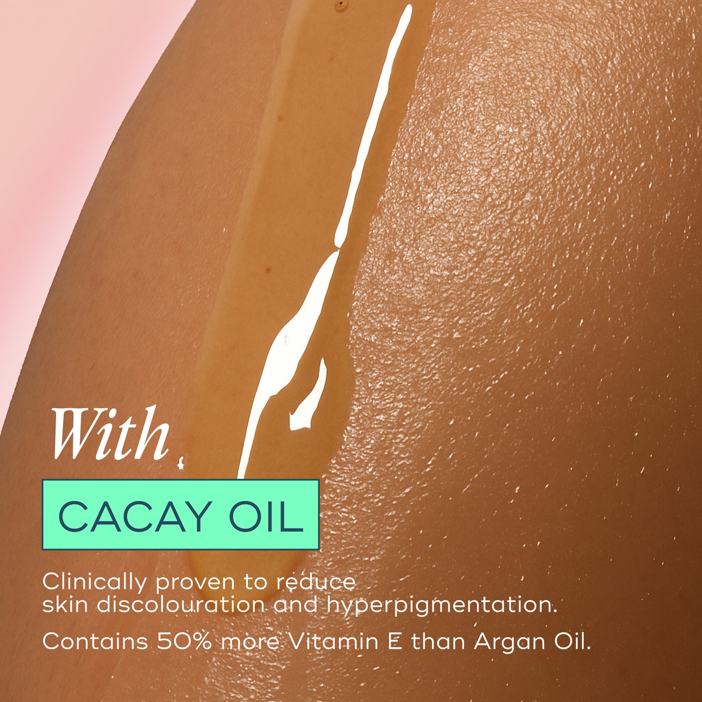 The Skin Support Oil - For Stretch Marks, Hyperpigmentation + Uneven Skin Texture